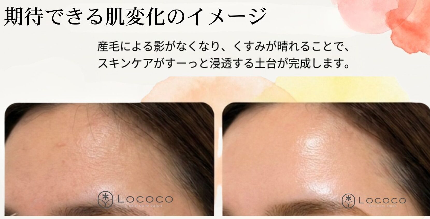 艶肌WAXビフォーアフター